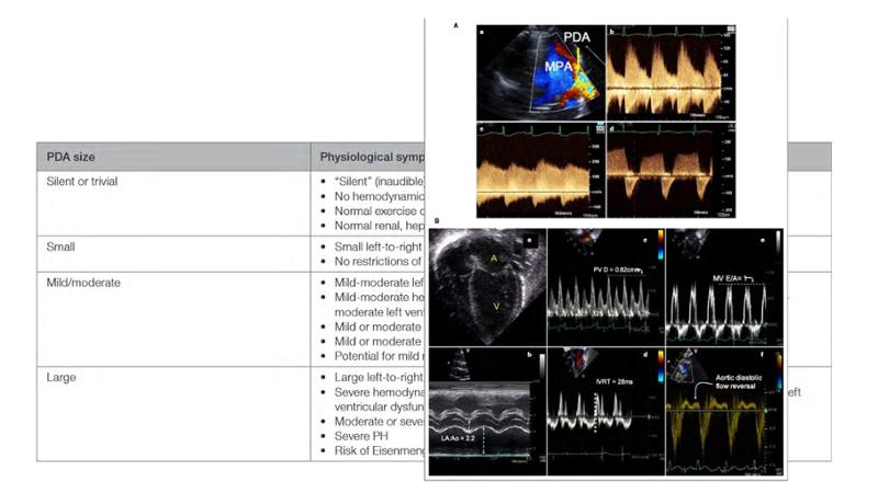 2025 Pediatric Heart Forum Presentation 7페이지