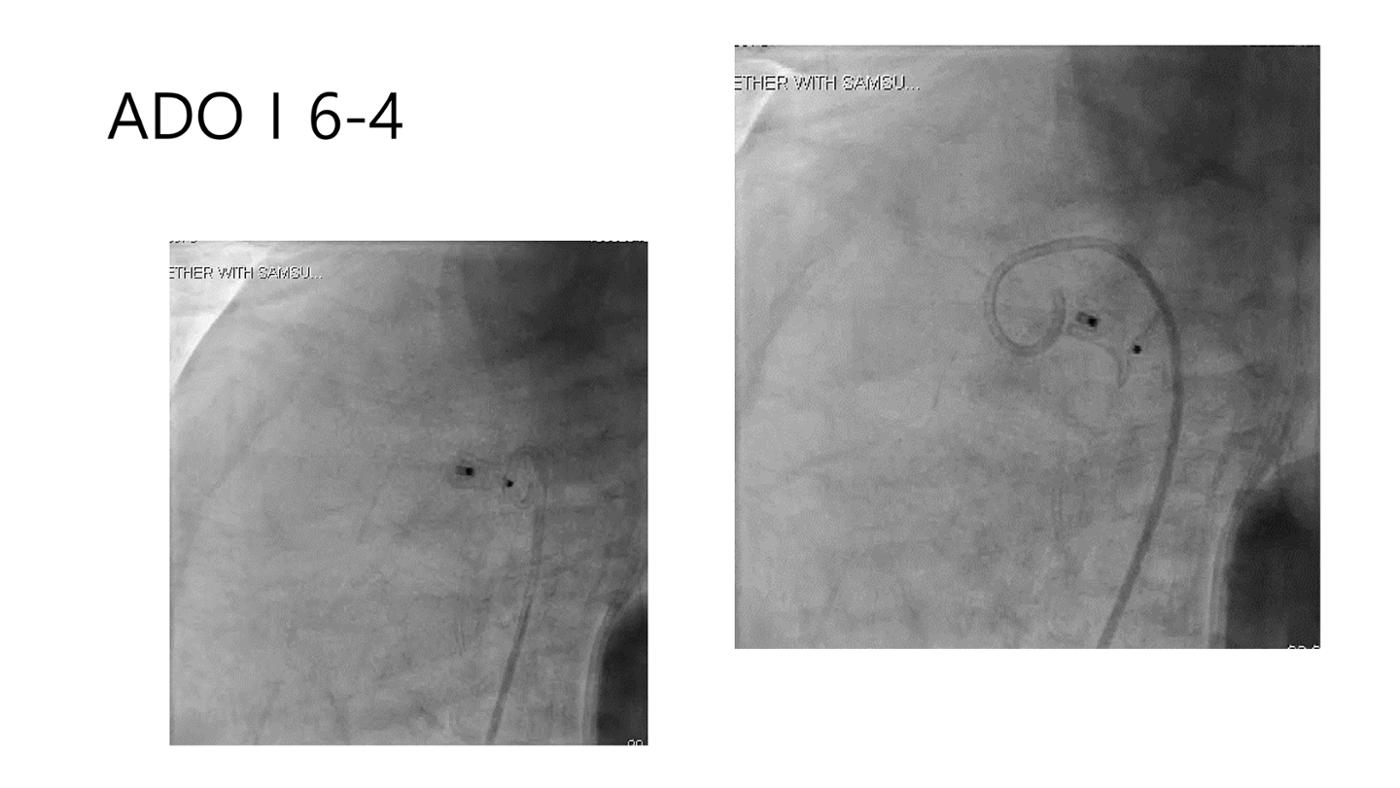 2025 Pediatric Heart Forum Presentation 39페이지
