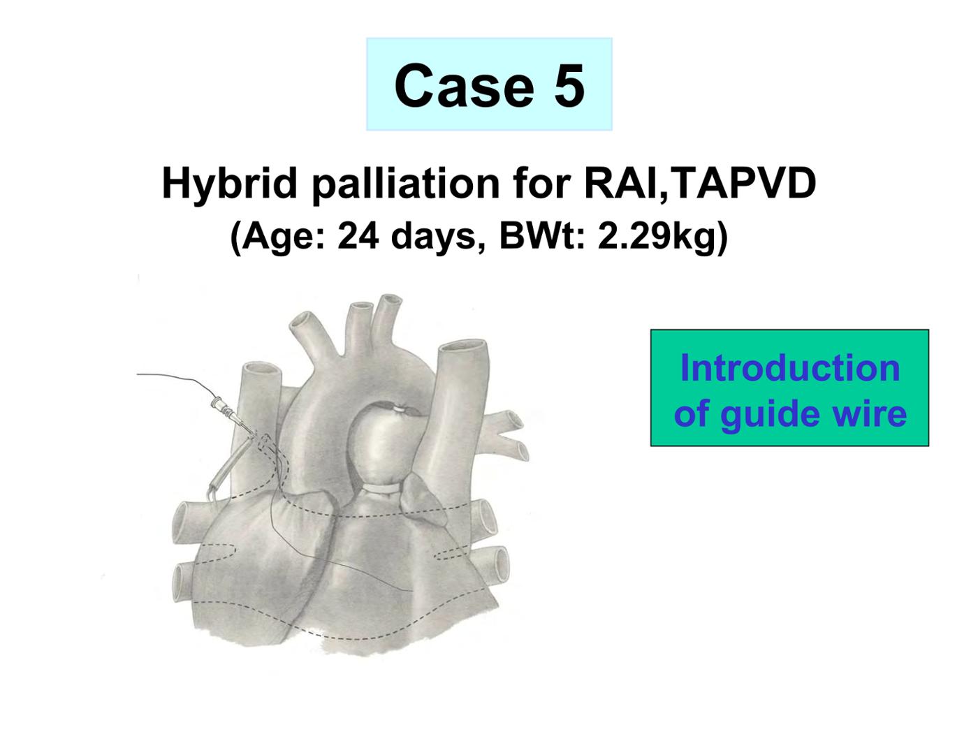 2025 Pediatric Heart Forum Presentation 352페이지