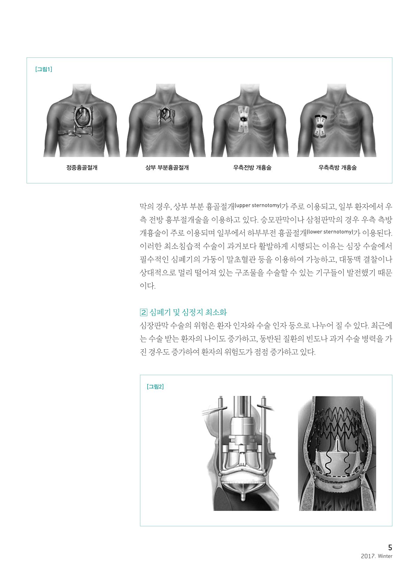 2017 심장소식 겨울호 6페이지