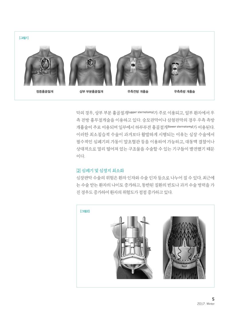 2017 심장소식 겨울호 6페이지