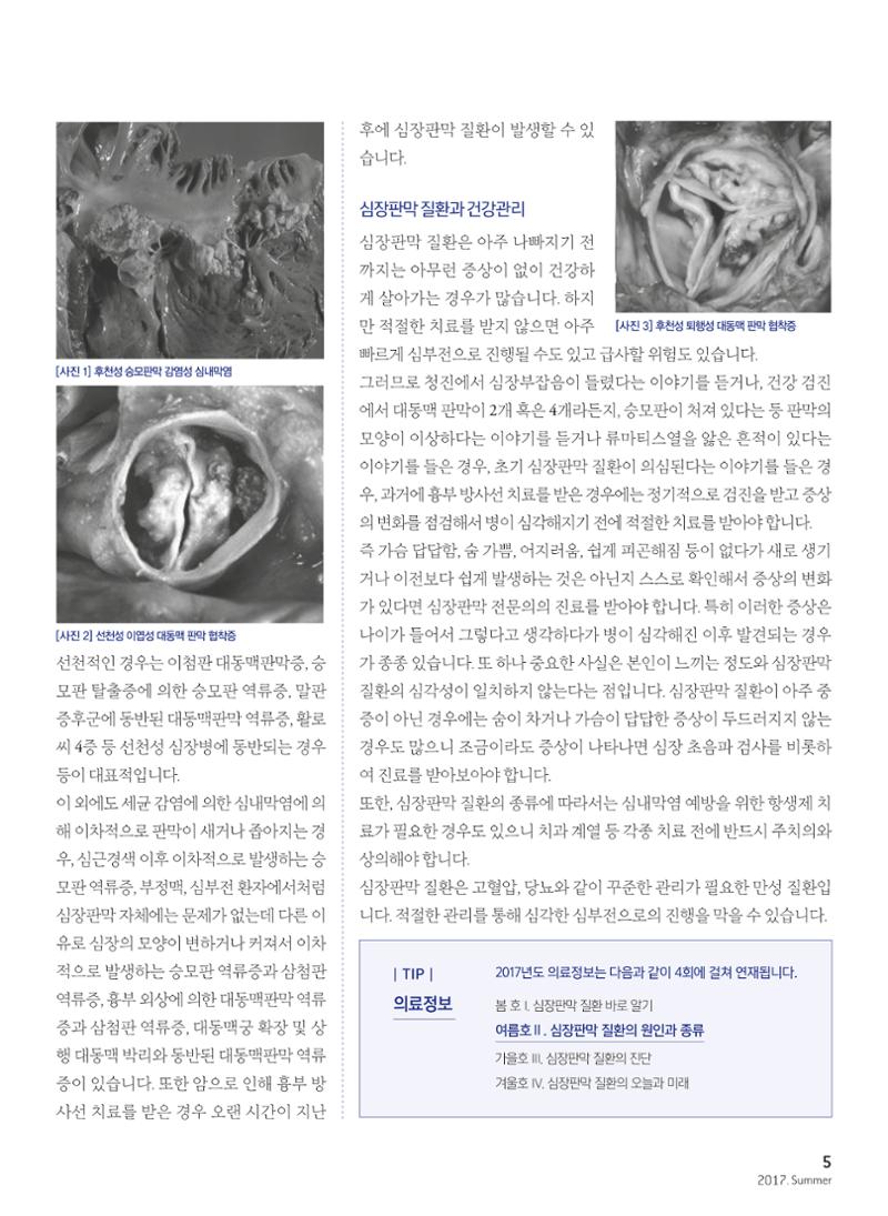2017 심장소식 여름호 114호 5페이지