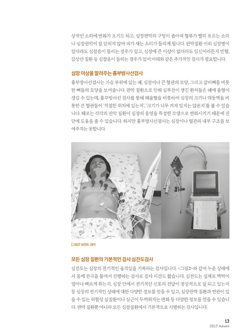 2017 심장소식 가을호 115호 13페이지