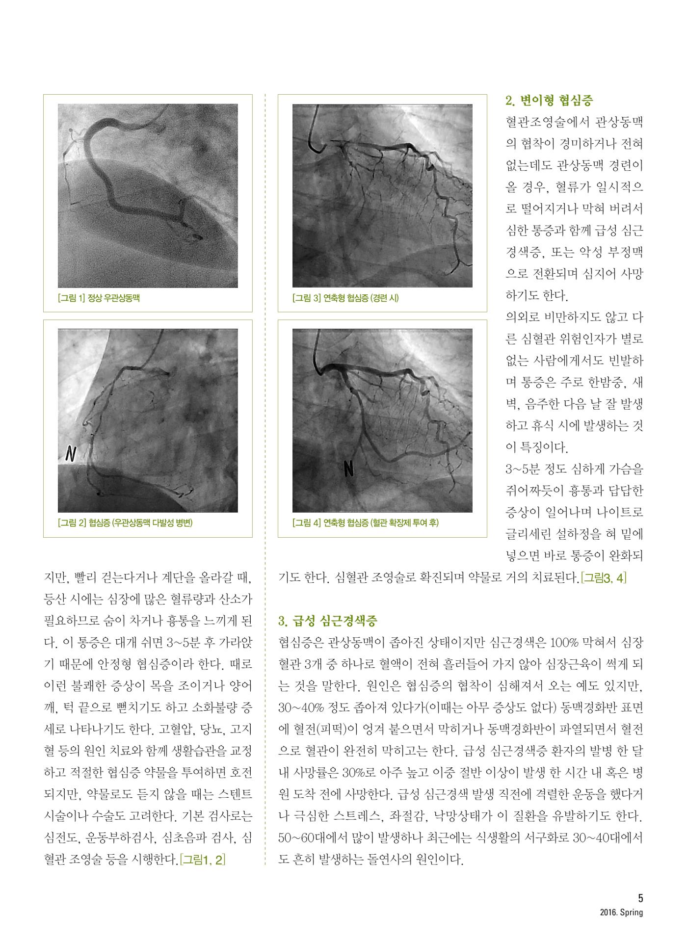 2016 심장소식 봄호 6페이지