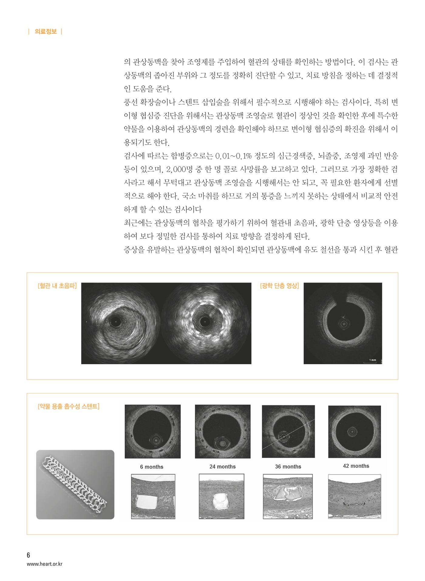 2016 심장소식 여름호 110호 7페이지