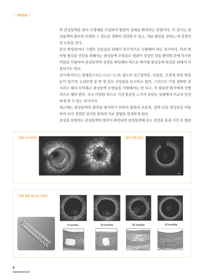 2016 심장소식 여름호 110호 7페이지