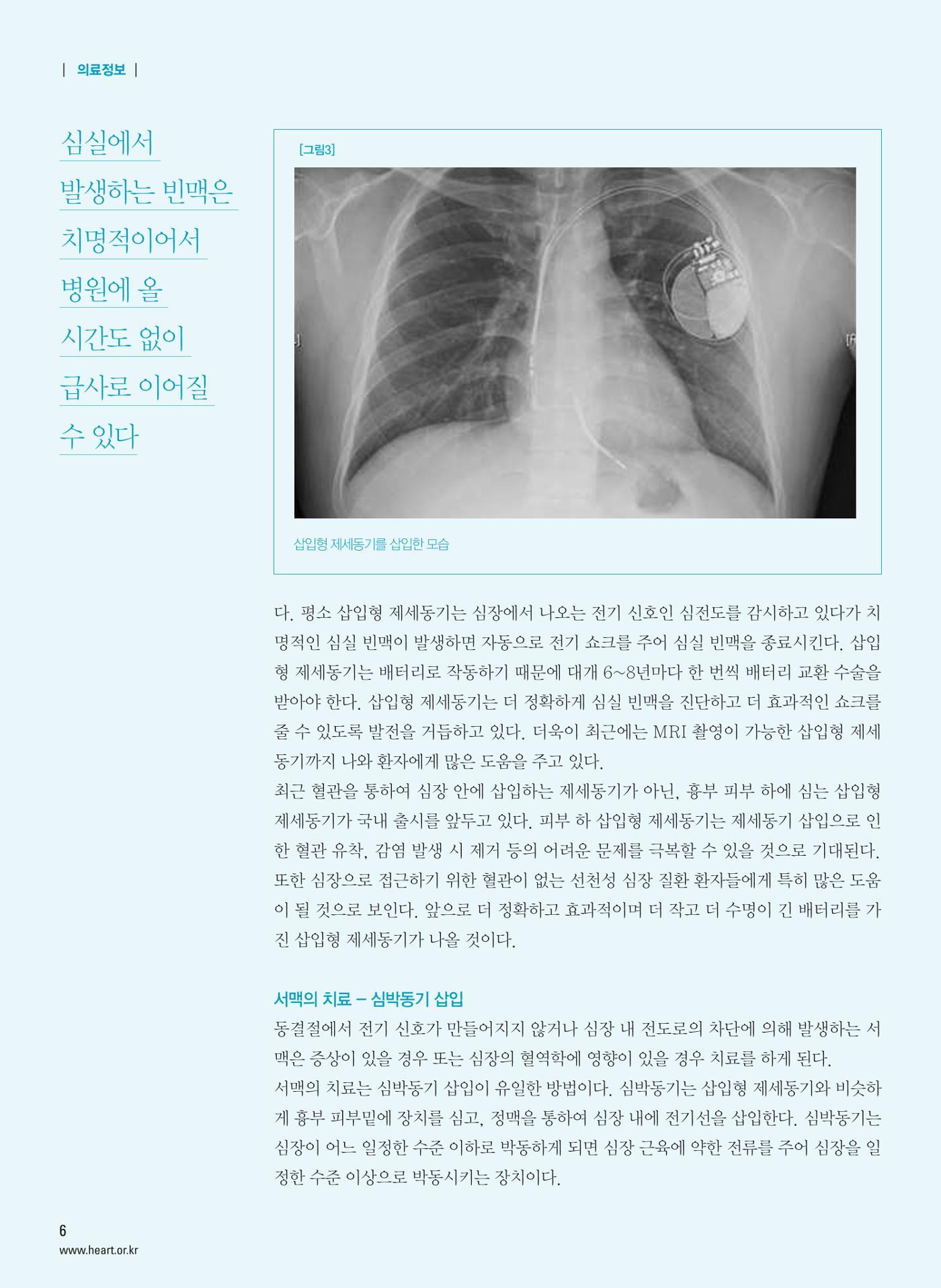 2015 심장소식 여름호 106호 6페이지