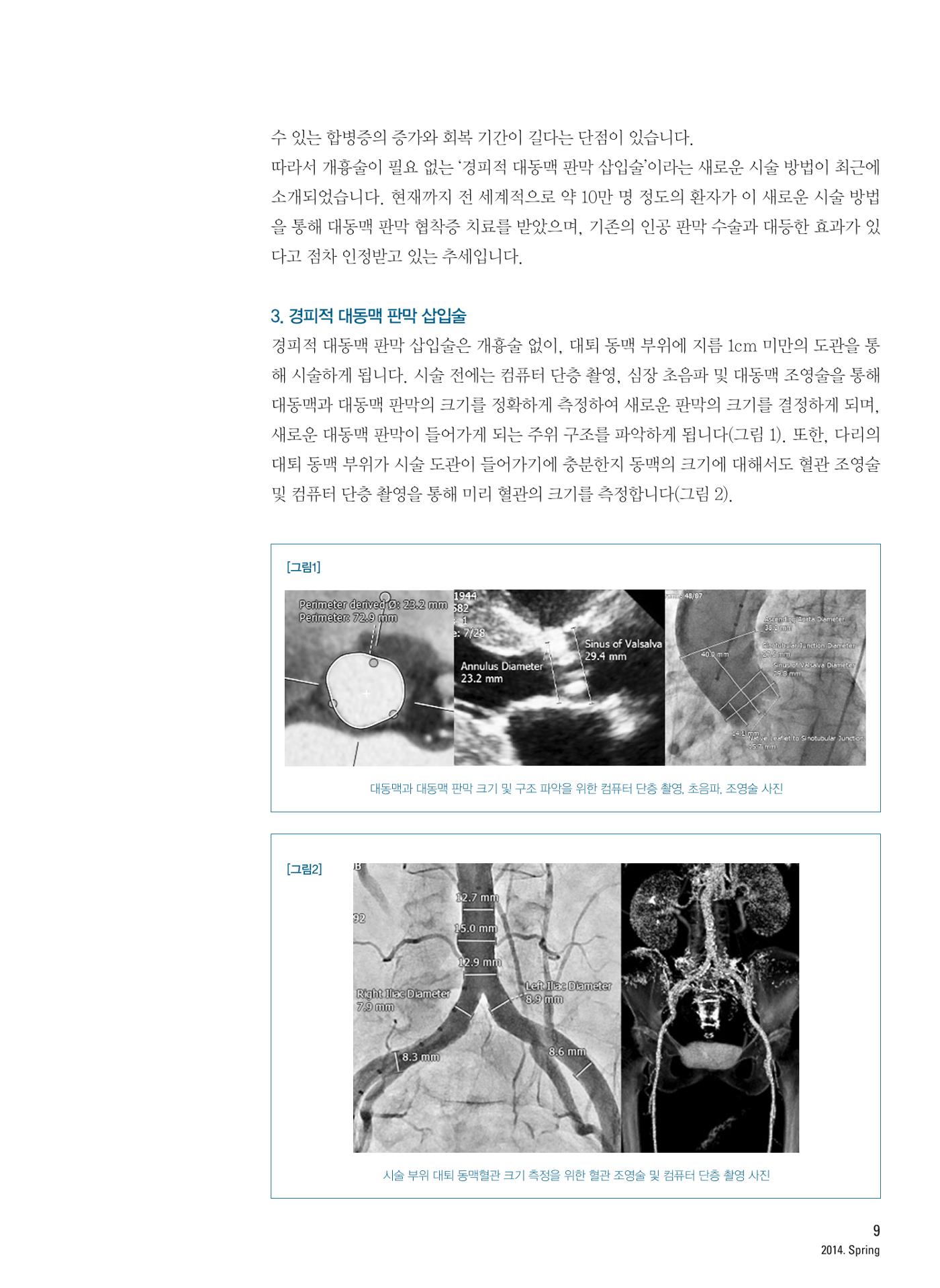 2014 심장소식 봄호 101호 10페이지