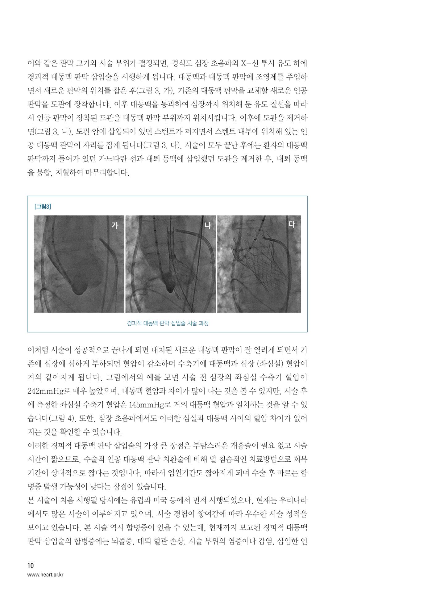2014 심장소식 봄호 101호 11페이지