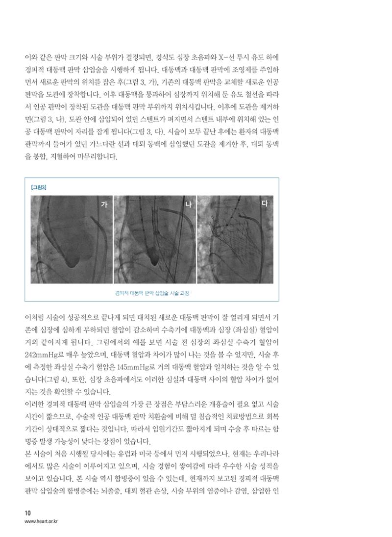 2014 심장소식 봄호 101호 11페이지