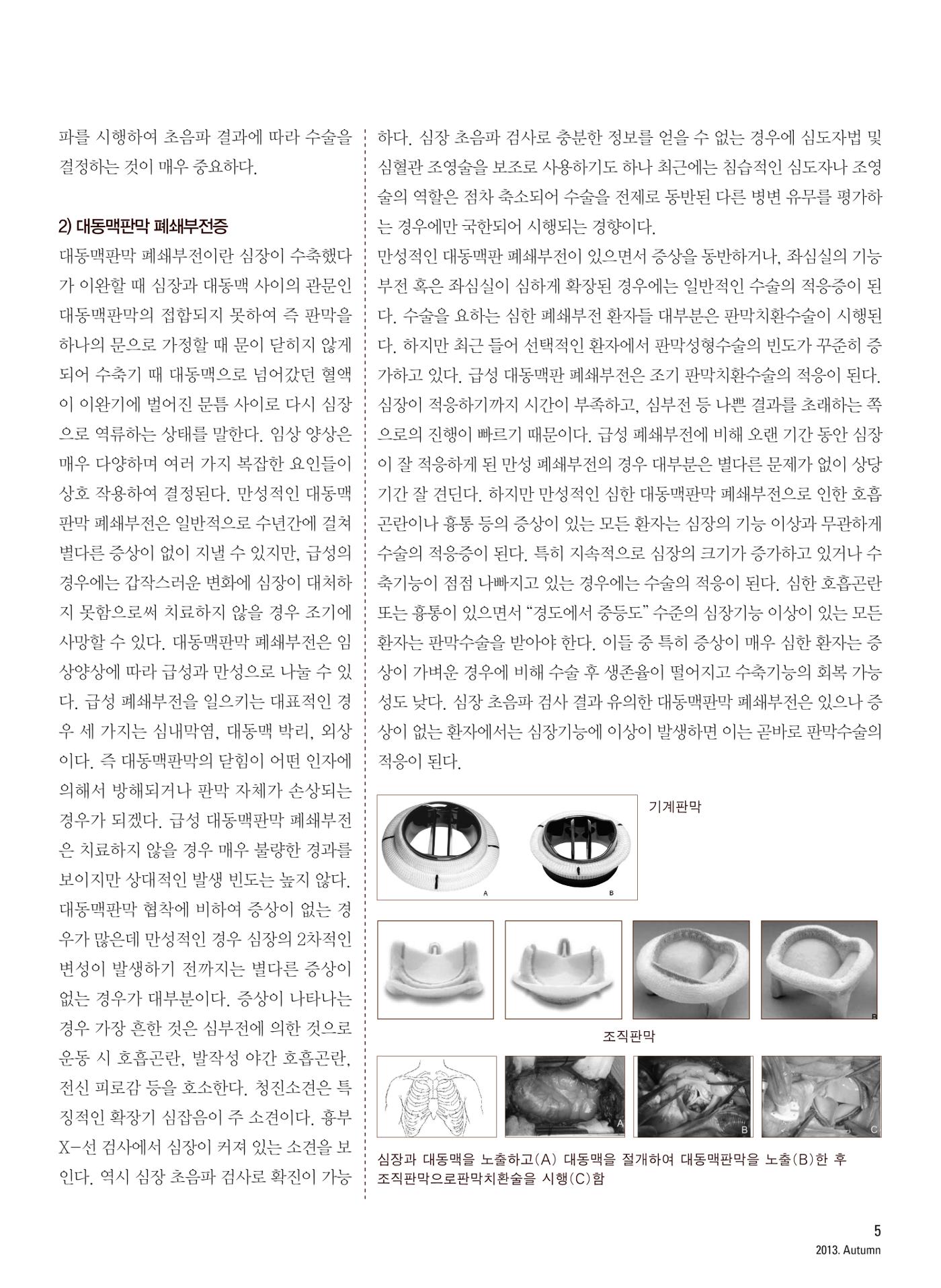 2013 심장소식 가을호 99호 6페이지