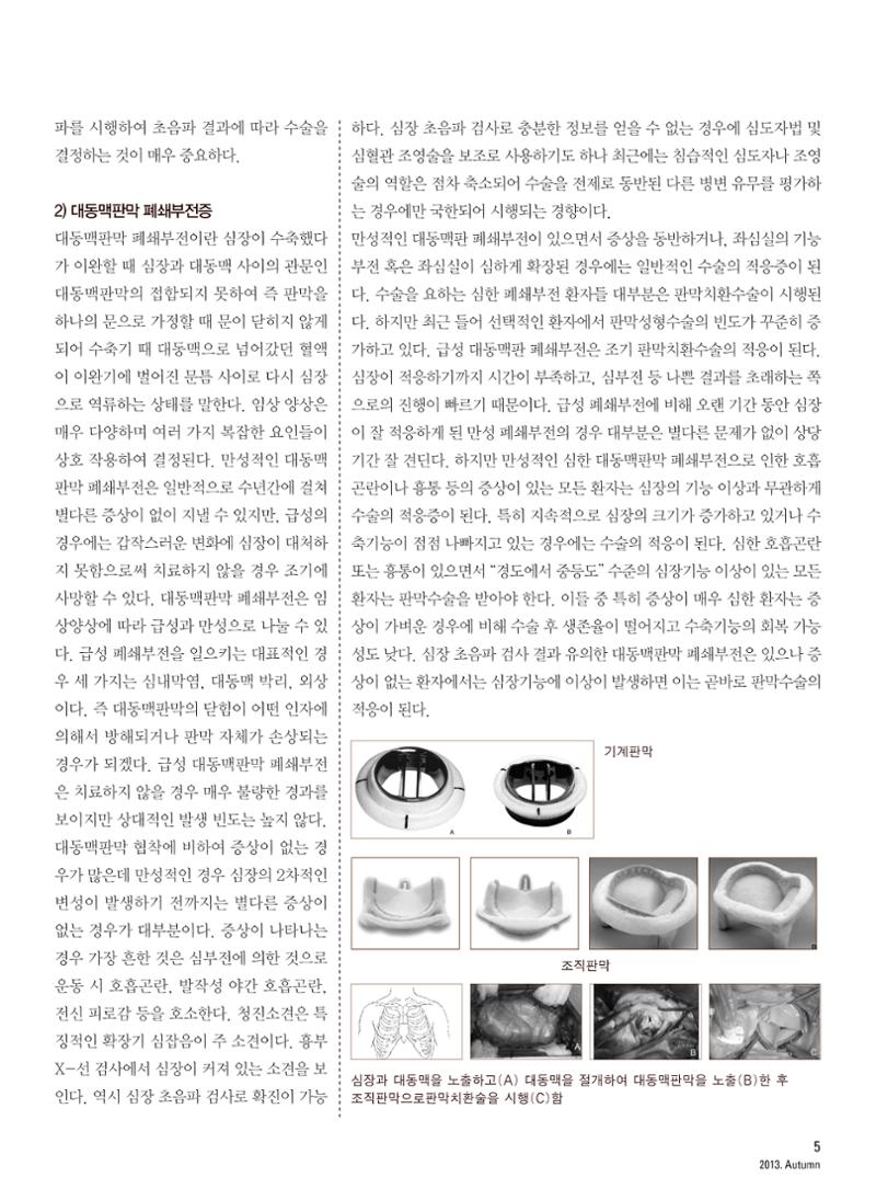 2013 심장소식 가을호 99호 6페이지