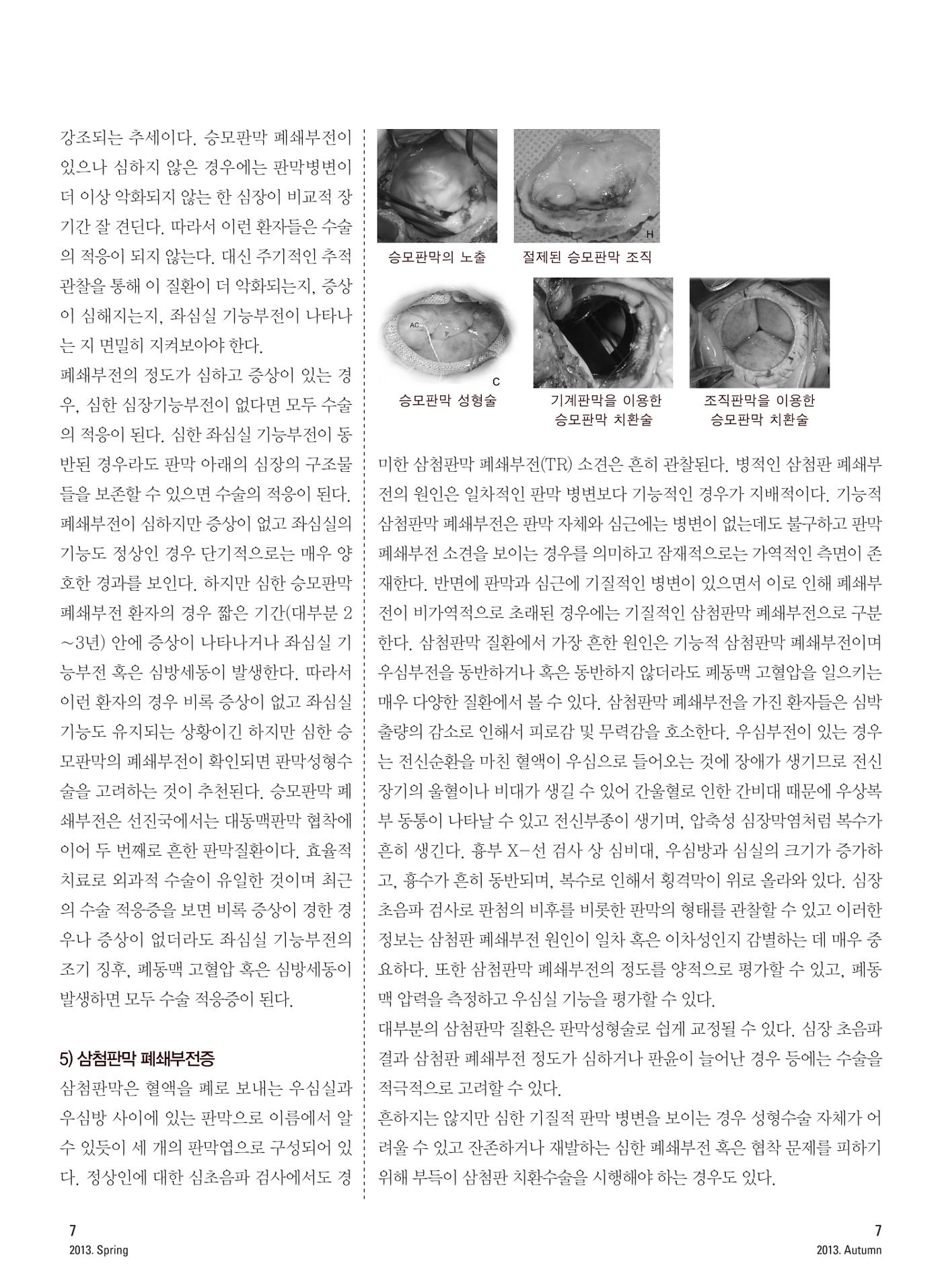 2013 심장소식 가을호 99호 8페이지