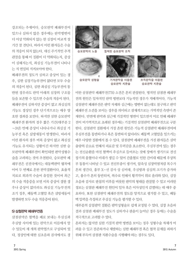 2013 심장소식 가을호 99호 8페이지