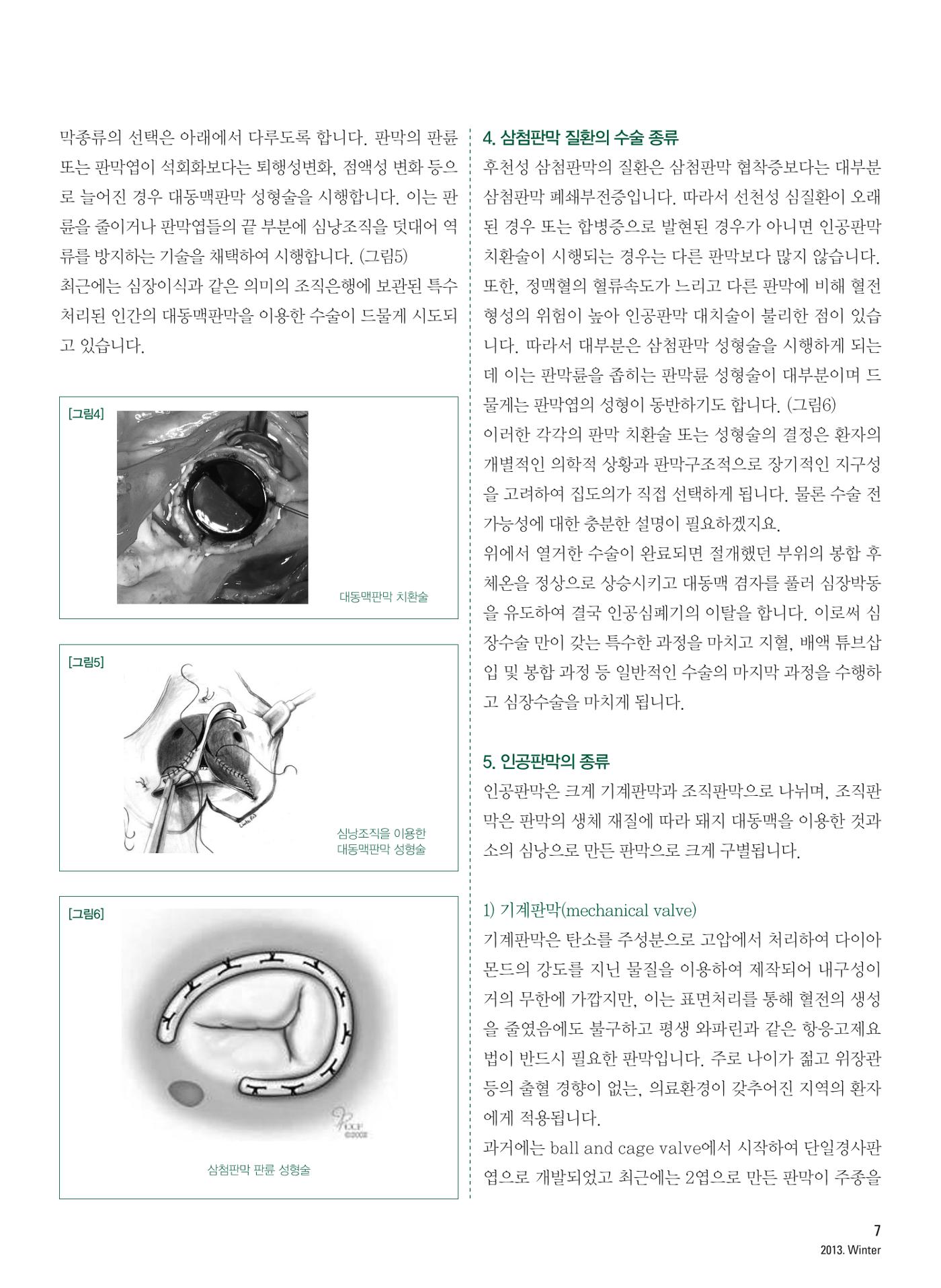 2013 심장소식 겨울호 100호 8페이지