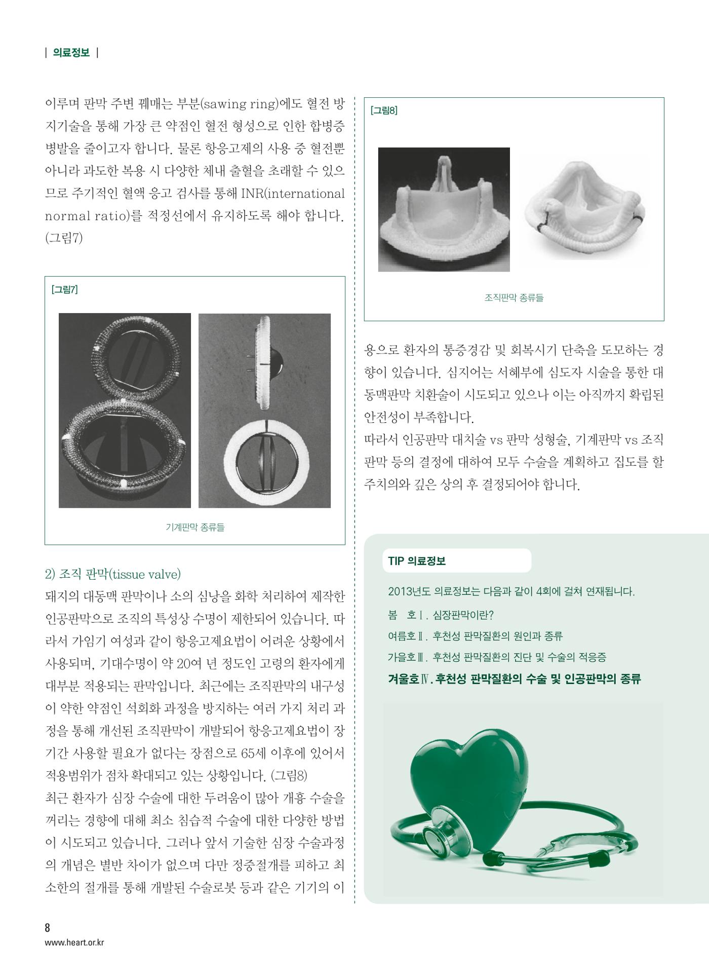 2013 심장소식 겨울호 100호 9페이지
