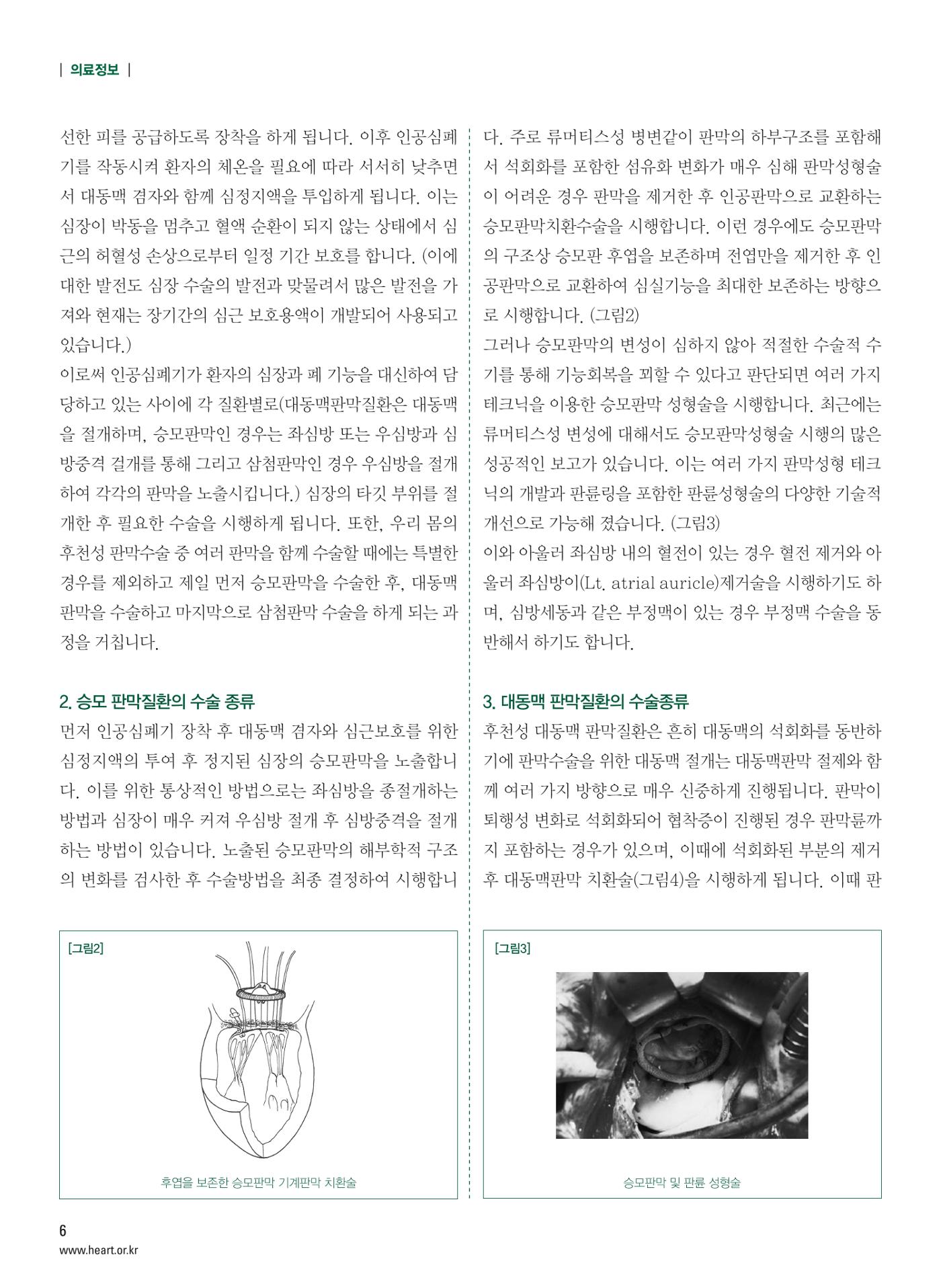 2013 심장소식 겨울호 100호 7페이지