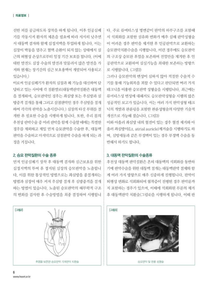 2013 심장소식 겨울호 100호 7페이지