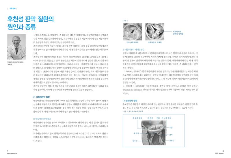 2013 심장소식 여름호 98호 5페이지