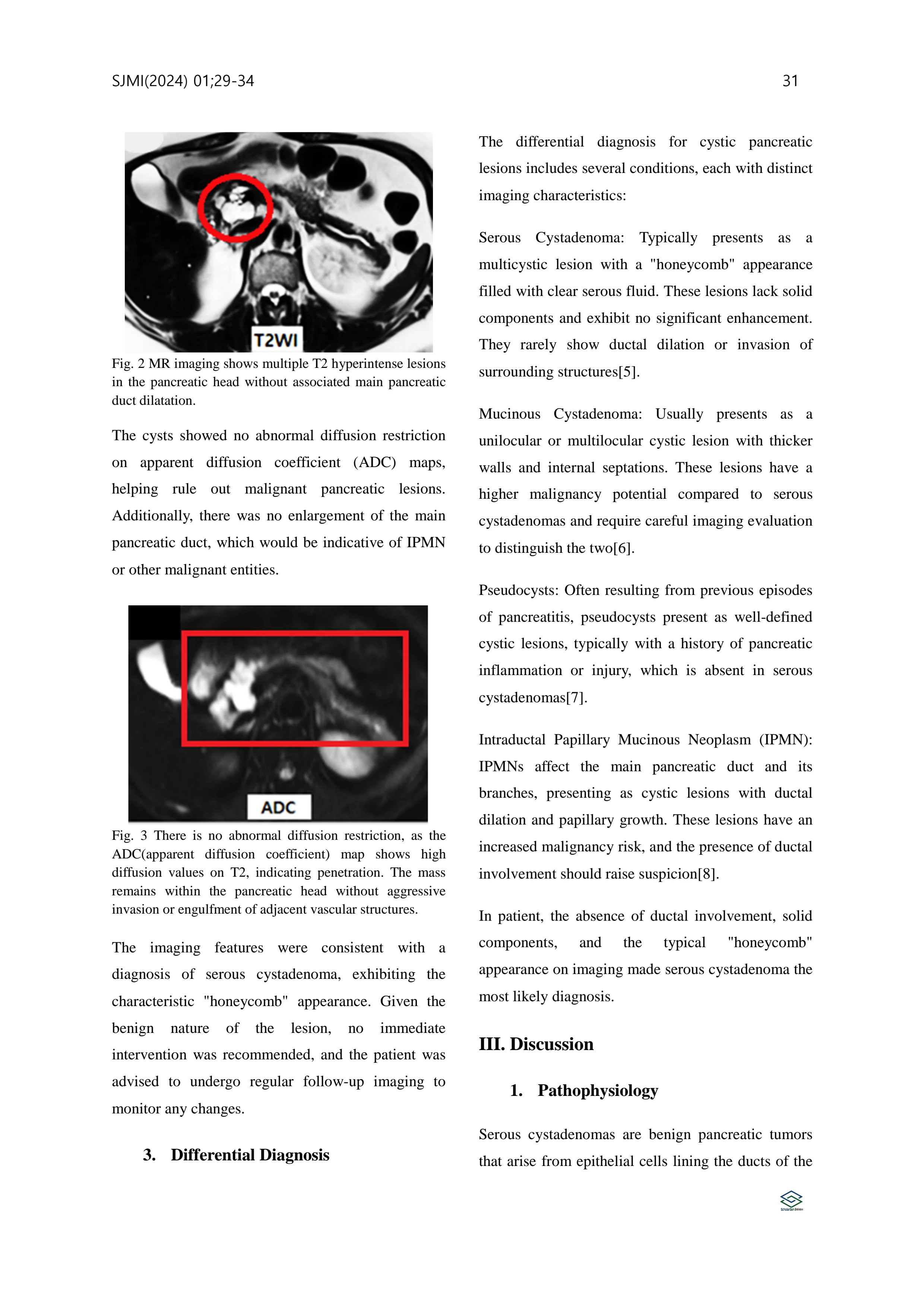 Journal of Medical Imaging Volume 7 35페이지