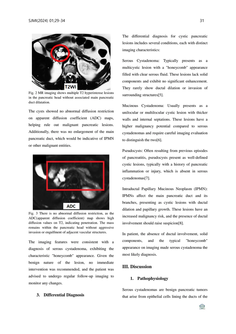 Journal of Medical Imaging Volume 7 35페이지
